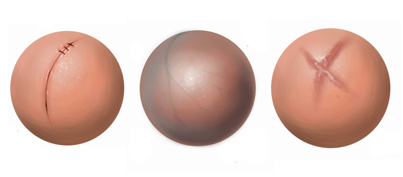 Making Different Human Skin Surfaces