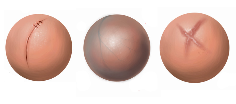 Making Different Human Skin Surfaces